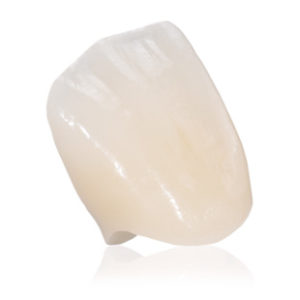 ips e.max ips e.max custom dental restoration